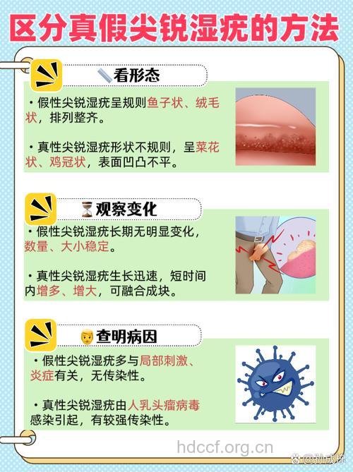 假性尖锐湿疣的临床症状有哪些?