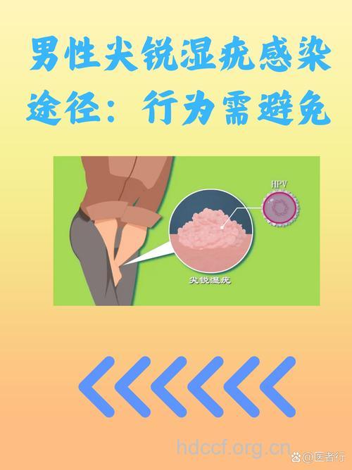 尖锐湿疣传播途径有哪些？