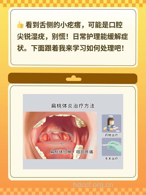 口腔内部长了尖锐湿疣要怎么办?