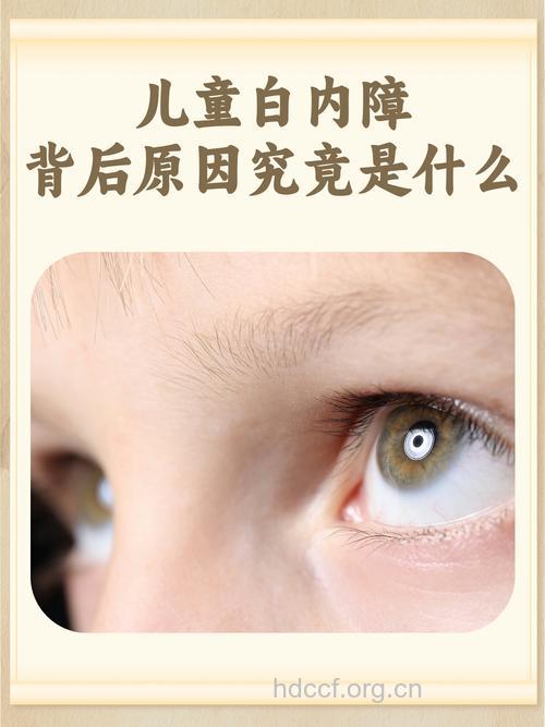 孩子屈光不正易患白内障吗