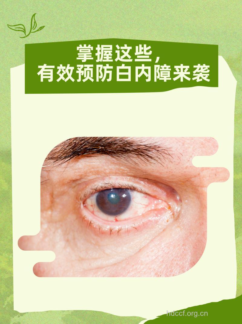 抗氧化剂易使白内障加重吗