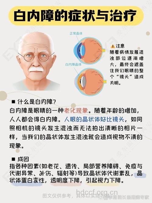 老人缺水会导致白内障吗