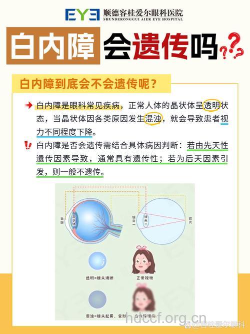 遗传是引发白内障的病因吗