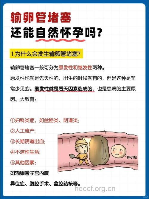 有哪些常见的输卵管性不孕
