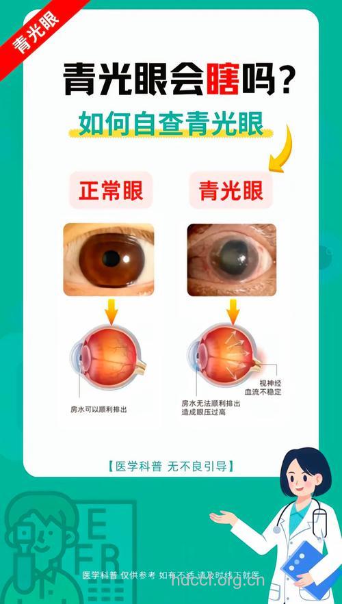 怎么检查出青光眼