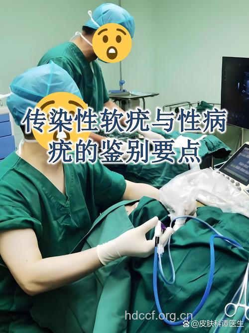 微波治疗传染性软疣的好处
