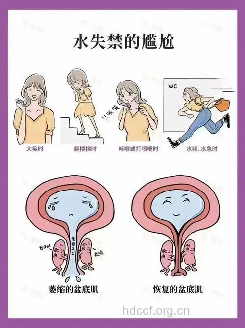 憋尿引起的女人不孕
