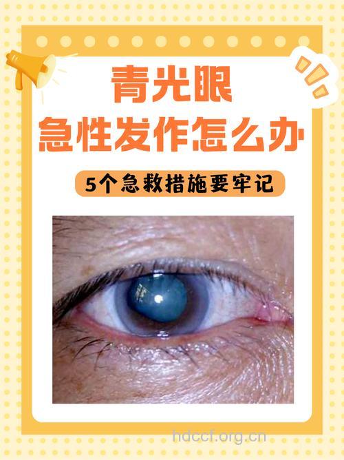 青光眼疾病会引起呕吐吗