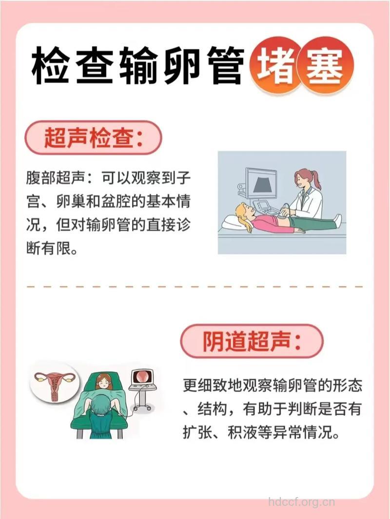 输卵管性不孕应该怎么做检查