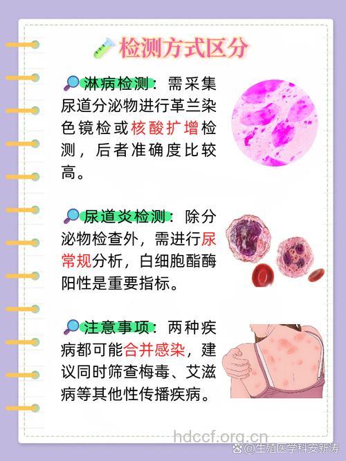 如何区分淋病和非淋病