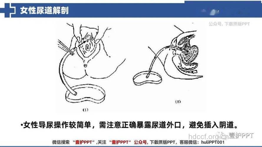 女性朋友怎么护理尿道方法