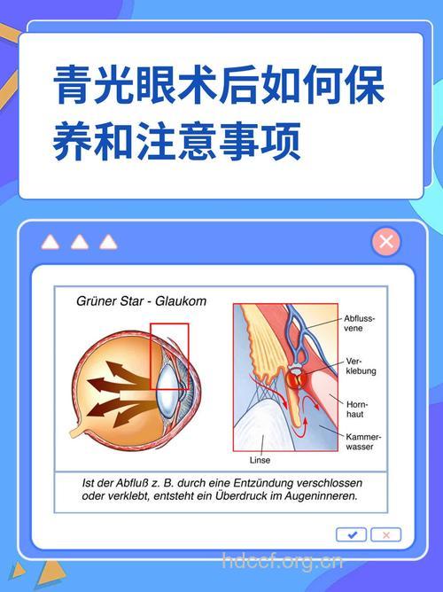 青光眼术后有哪些保健方法