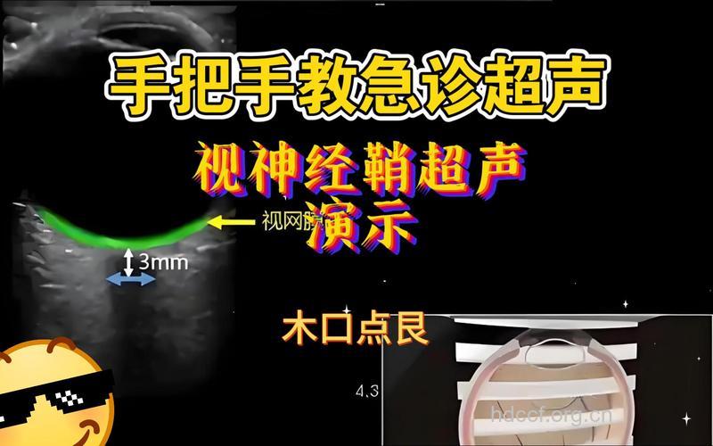 眼睛怎么进行超声检查方法