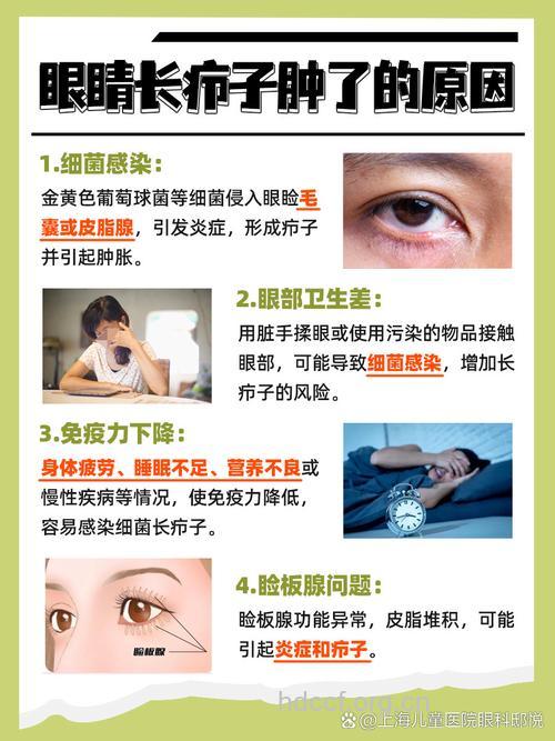 哪些原因导致眼部肿瘤