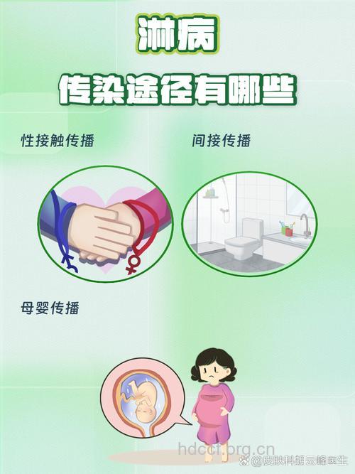 淋病的传染途径及预防方法