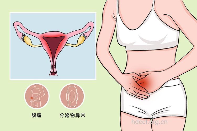 小心盆腔结核会导致不孕