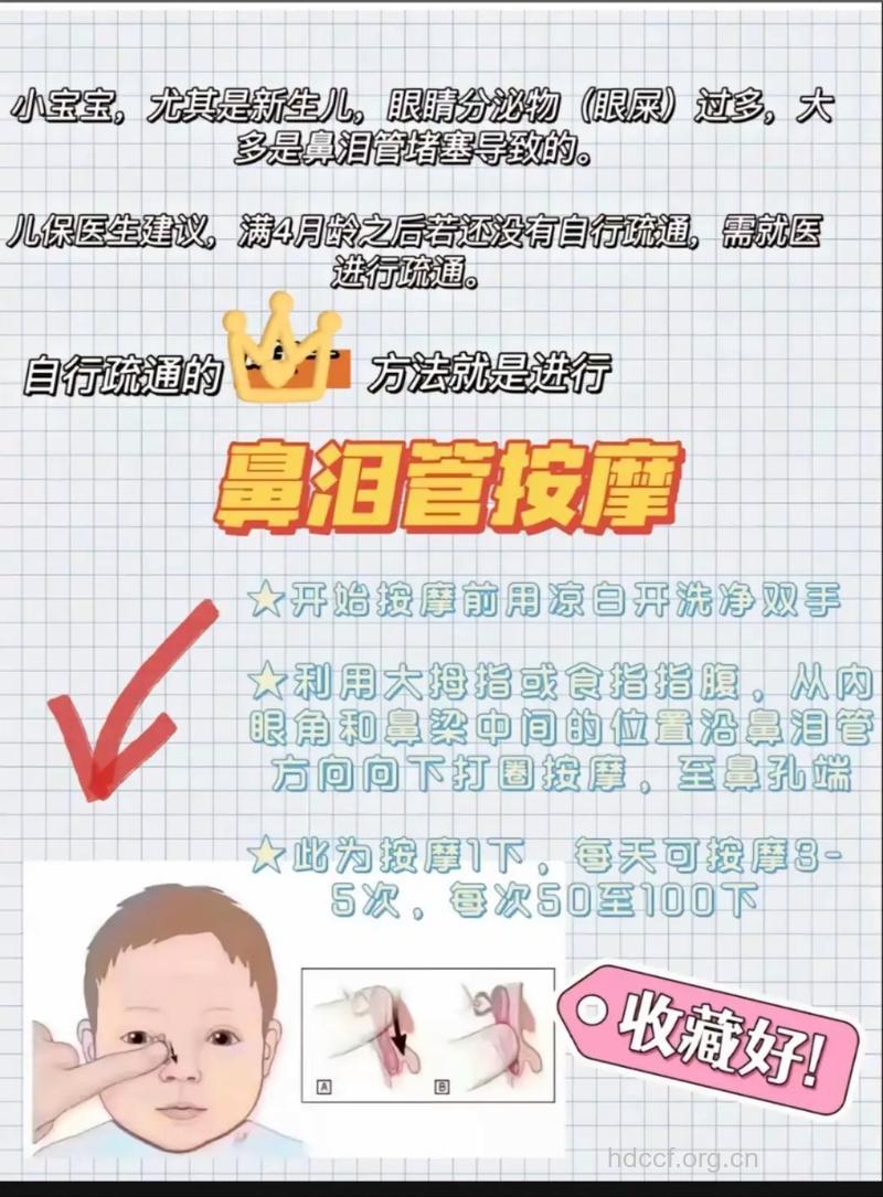 鼻泪管狭窄有哪些治疗方法