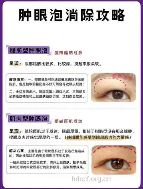 肿眼泡有哪些治疗方法