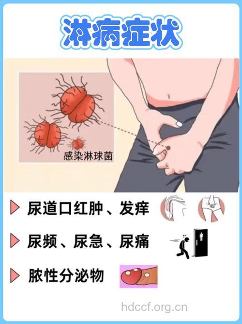 淋病的临床表现