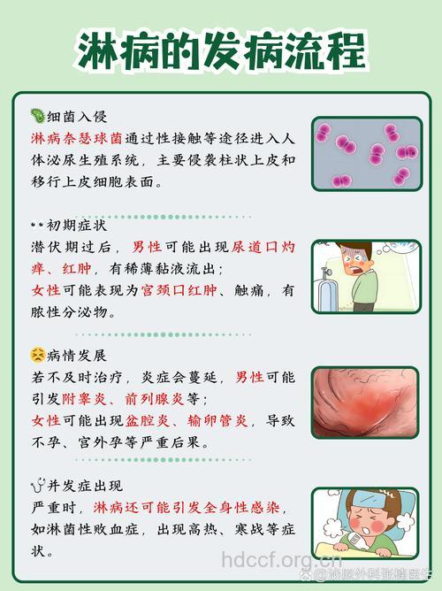 淋病潜伏多久后有症状