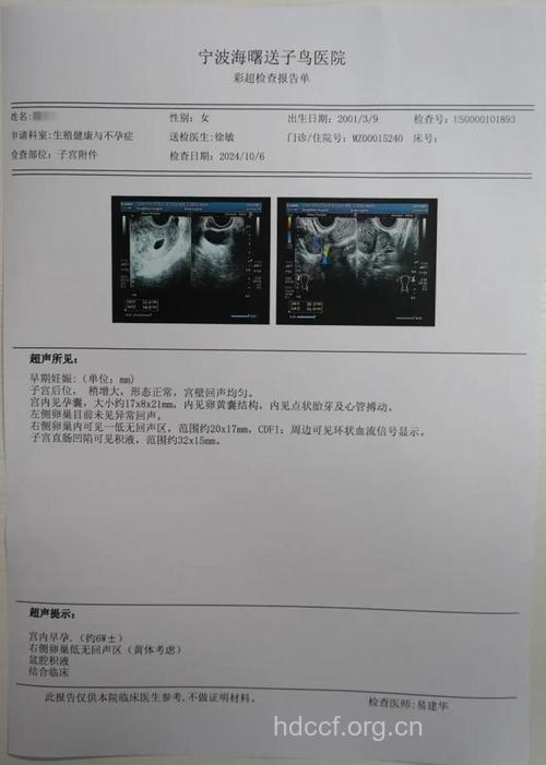 不孕症B超结果如何看?