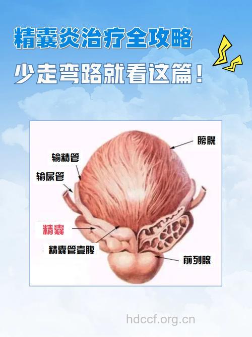 什么原因会引起精囊炎