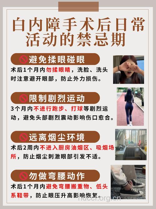 白内障术前有哪些准备工作