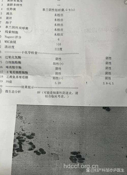 宫颈粘液检查结果怎么看?