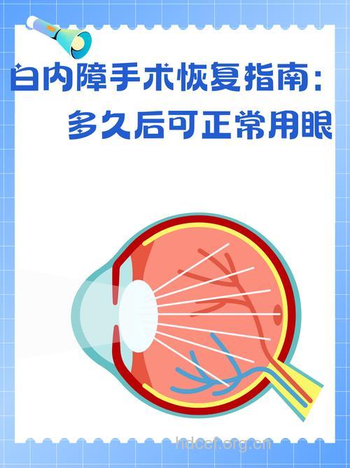 老人白内障术后怎么矫正视力方法