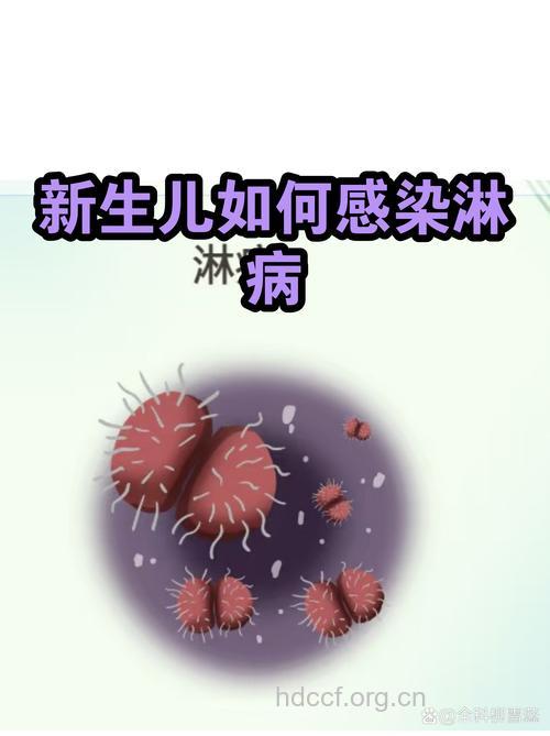 淋病对新生儿有哪些危害