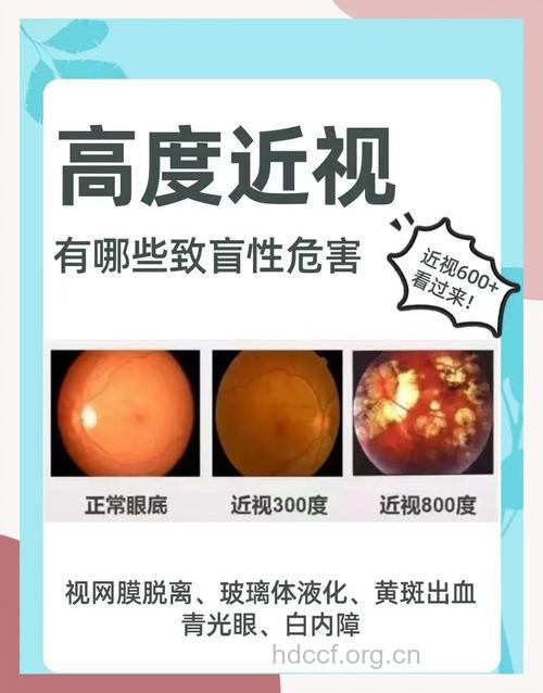 高度近视竟会引发失明