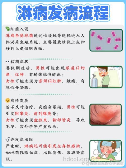 淋病治愈有哪些标准
