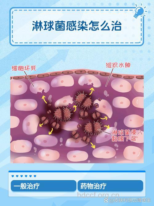 淋病的发病机制是什么