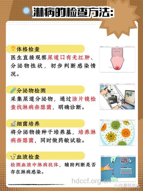 关于淋病有哪些检查方法