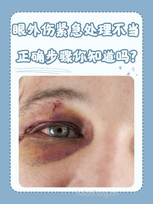 穿孔性眼外伤严重吗
