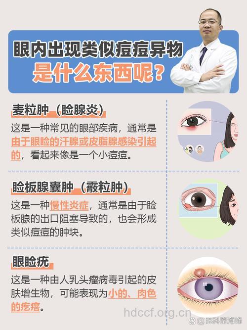 眼异物的症状及治疗