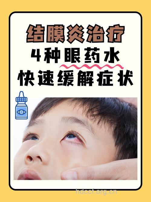 眼药水能预防红眼病吗
