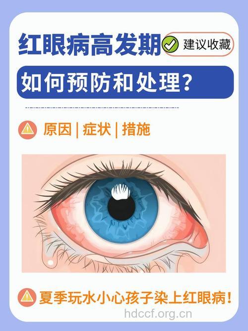 夏天红眼病高发季
