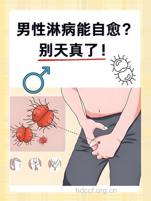 “被淋病”引起的家庭危机