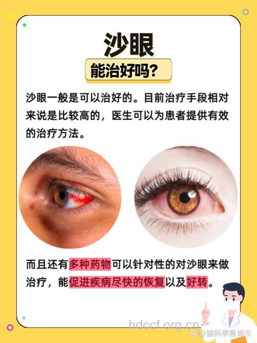 沙眼程度不同用药不同
