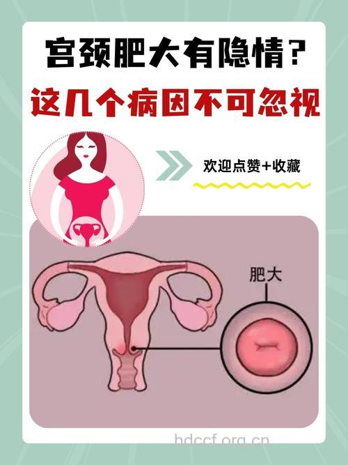 为何宫颈肥大可导致不孕?