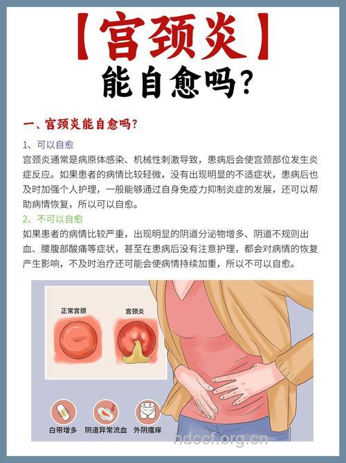 慢性宫颈炎需积极治疗 以防不孕
