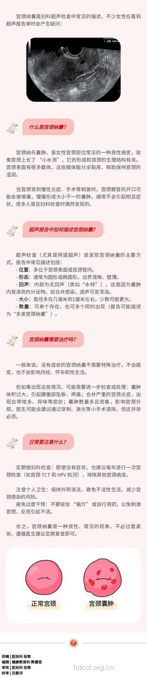 宫颈那囊对生育有何影响?