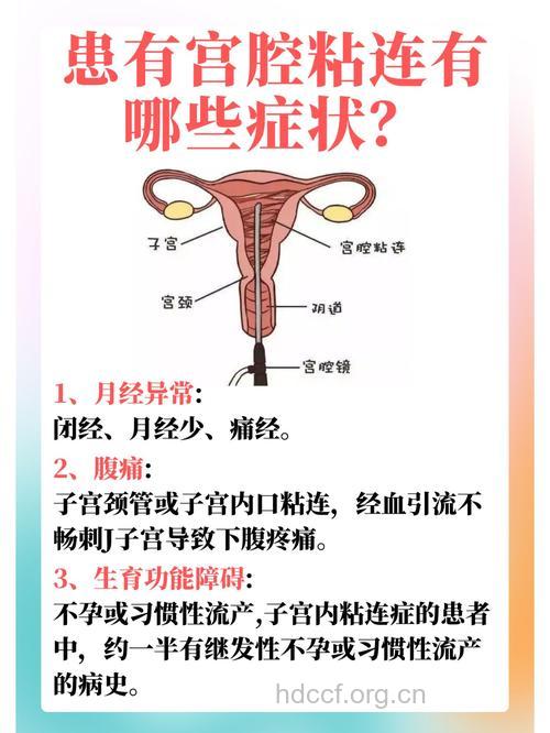闭经、月经稀少性不孕 需考虑宫腔粘连