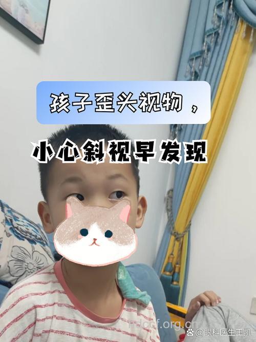 散光导致了孩子歪头看东西