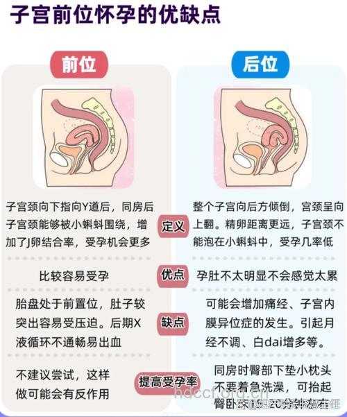 无盆腔粘连 子宫后位不影响怀孕率