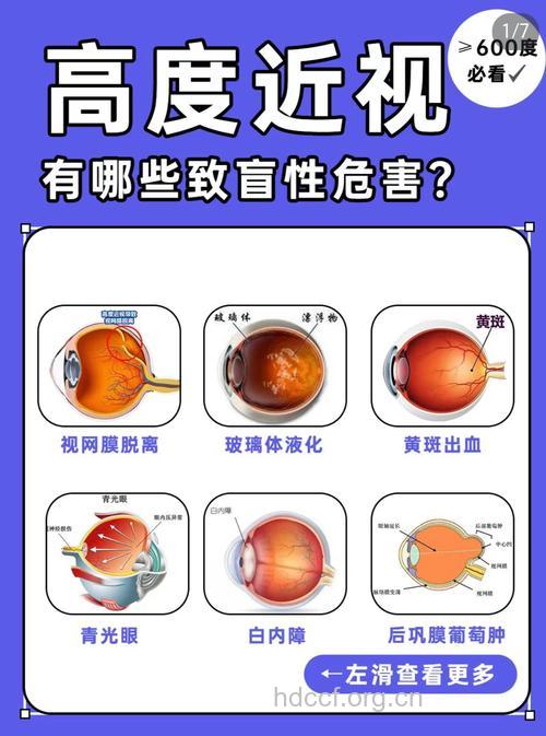 高度近视的危害有哪些？