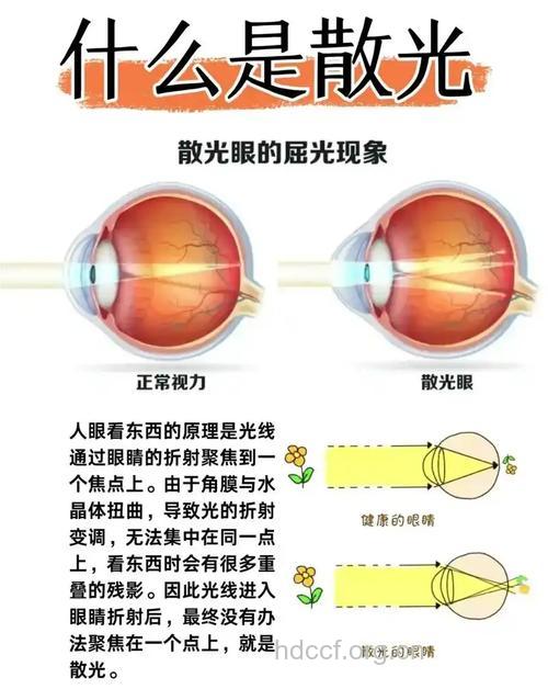 眼睛散光的几种不同类型
