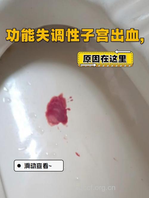 功能失调性子宫出血有哪些症状?