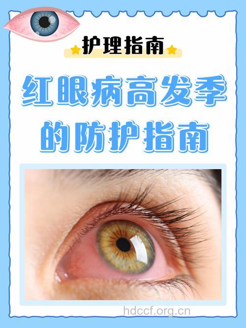 红眼病的防治及注意事项